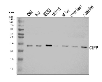 Anti-CLPP Antibody