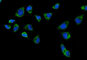 Anti-CPS1 Antibody