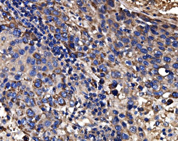 Anti-CPS1 Antibody