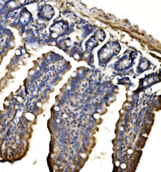 Anti-CPS1 Antibody