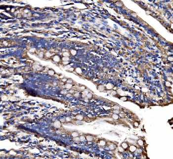 Anti-CPS1 Antibody