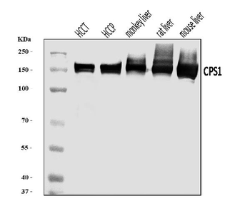 Anti-CPS1 Antibody