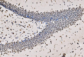Anti-CPSF6 Antibody