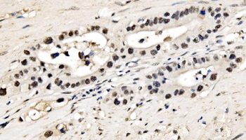 Anti-CPSF6 Antibody