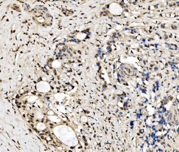Anti-CPSF6 Antibody