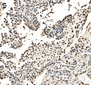 Anti-CPSF6 Antibody