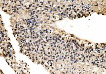 Anti-CPSF6 Antibody