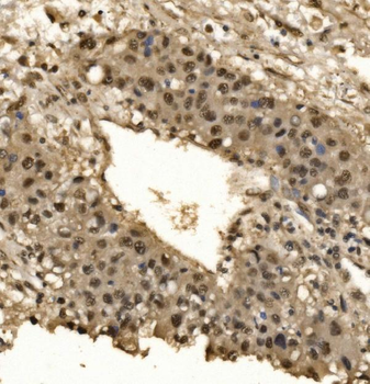 Anti-CPSF6 Antibody