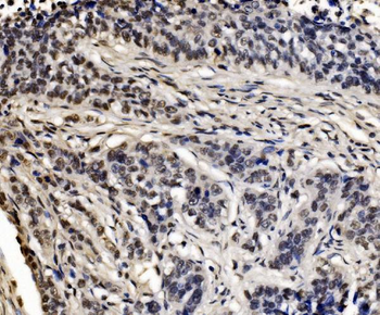 Anti-CPSF6 Antibody