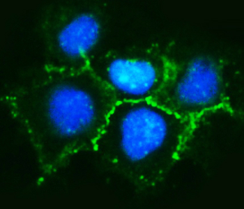 Anti-delta 1 Catenin/CAS/CTNND1 Antibody