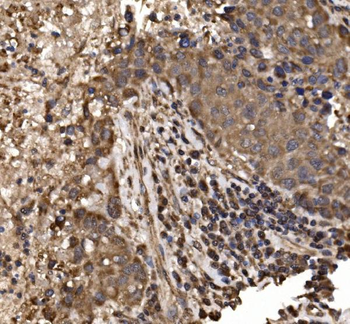 Anti-delta 1 Catenin/CAS/CTNND1 Antibody