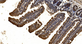 Anti-delta 1 Catenin/CAS/CTNND1 Antibody