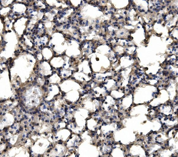 Anti-delta 1 Catenin/CAS/CTNND1 Antibody