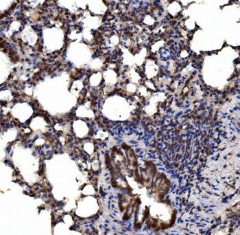 Anti-delta 1 Catenin/CAS/CTNND1 Antibody