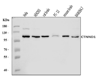 Anti-delta 1 Catenin/CAS/CTNND1 Antibody