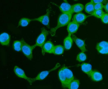 Anti-Drebrin/DBN1 Antibody