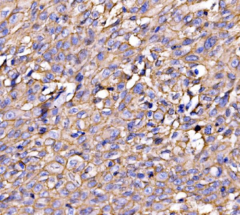 Anti-Drebrin/DBN1 Antibody