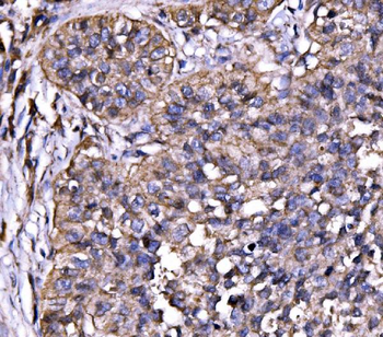 Anti-Drebrin/DBN1 Antibody