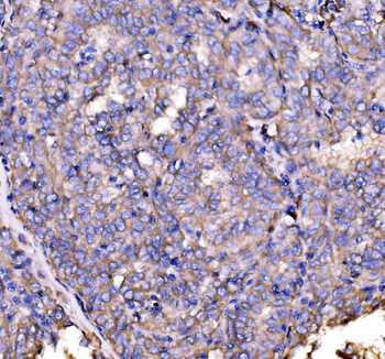 Anti-Drebrin/DBN1 Antibody
