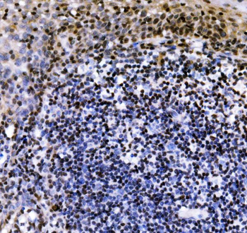 Anti-VPRBP/DCAF1 Antibody