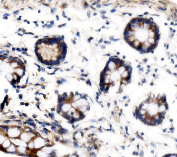 Anti-VPRBP/DCAF1 Antibody