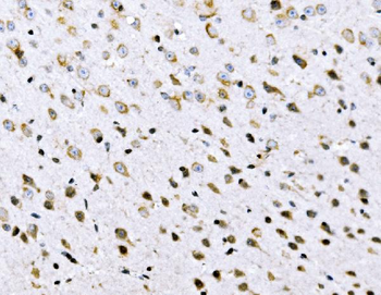 Anti-VPRBP/DCAF1 Antibody