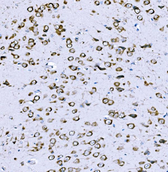 Anti-VPRBP/DCAF1 Antibody