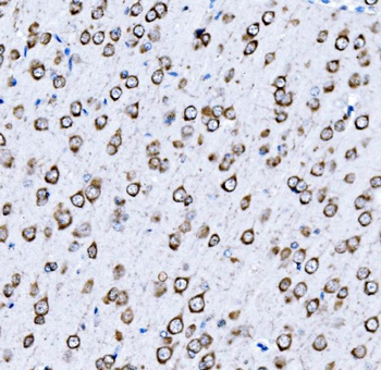 Anti-VPRBP/DCAF1 Antibody