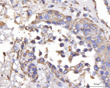 Anti-DLST Antibody
