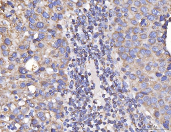 Anti-DLST Antibody