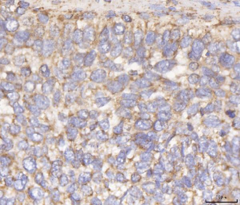 Anti-DLST Antibody