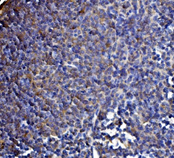 Anti-DLST Antibody