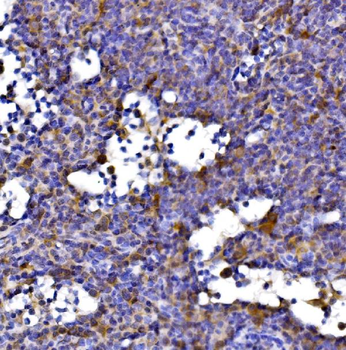 Anti-DLST Antibody