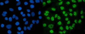 Anti-DMAP1 Antibody