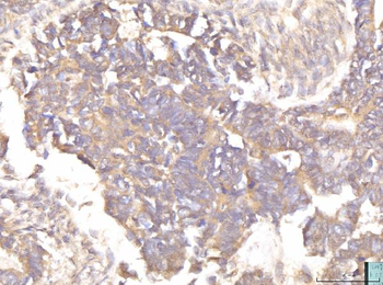 Anti-EIF4B Antibody