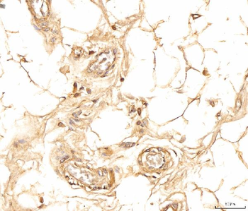 Anti-EIF4B Antibody