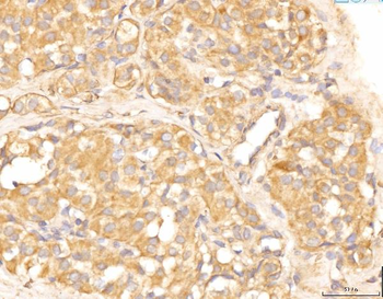 Anti-EIF4B Antibody