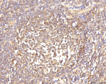 Anti-EIF4B Antibody