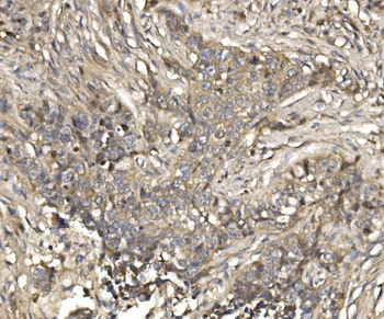 Anti-EIF4EBP1 Antibody