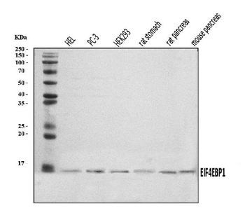 Anti-EIF4EBP1 Antibody