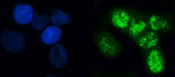 Anti-ELL Antibody