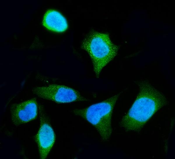 Anti-ENO3 Antibody