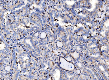 Anti-EVL Antibody