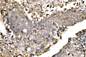 Anti-EVL Antibody