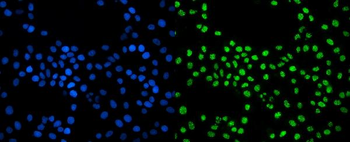 Anti-EXOSC3 Antibody