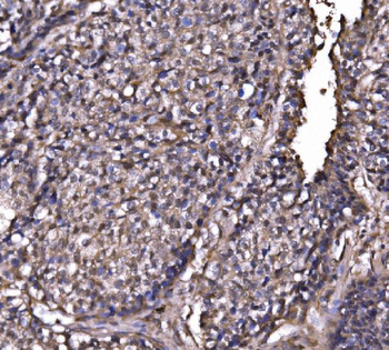 Anti-EXOSC3 Antibody