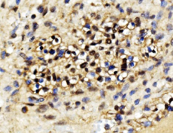 Anti-EXOSC3 Antibody