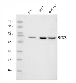 Anti-EXOSC3 Antibody