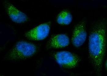 Anti-Fibulin 1/FBLN1 Antibody