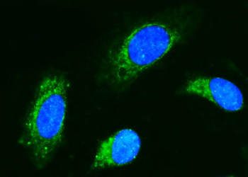 Anti-CD89/FCAR Antibody